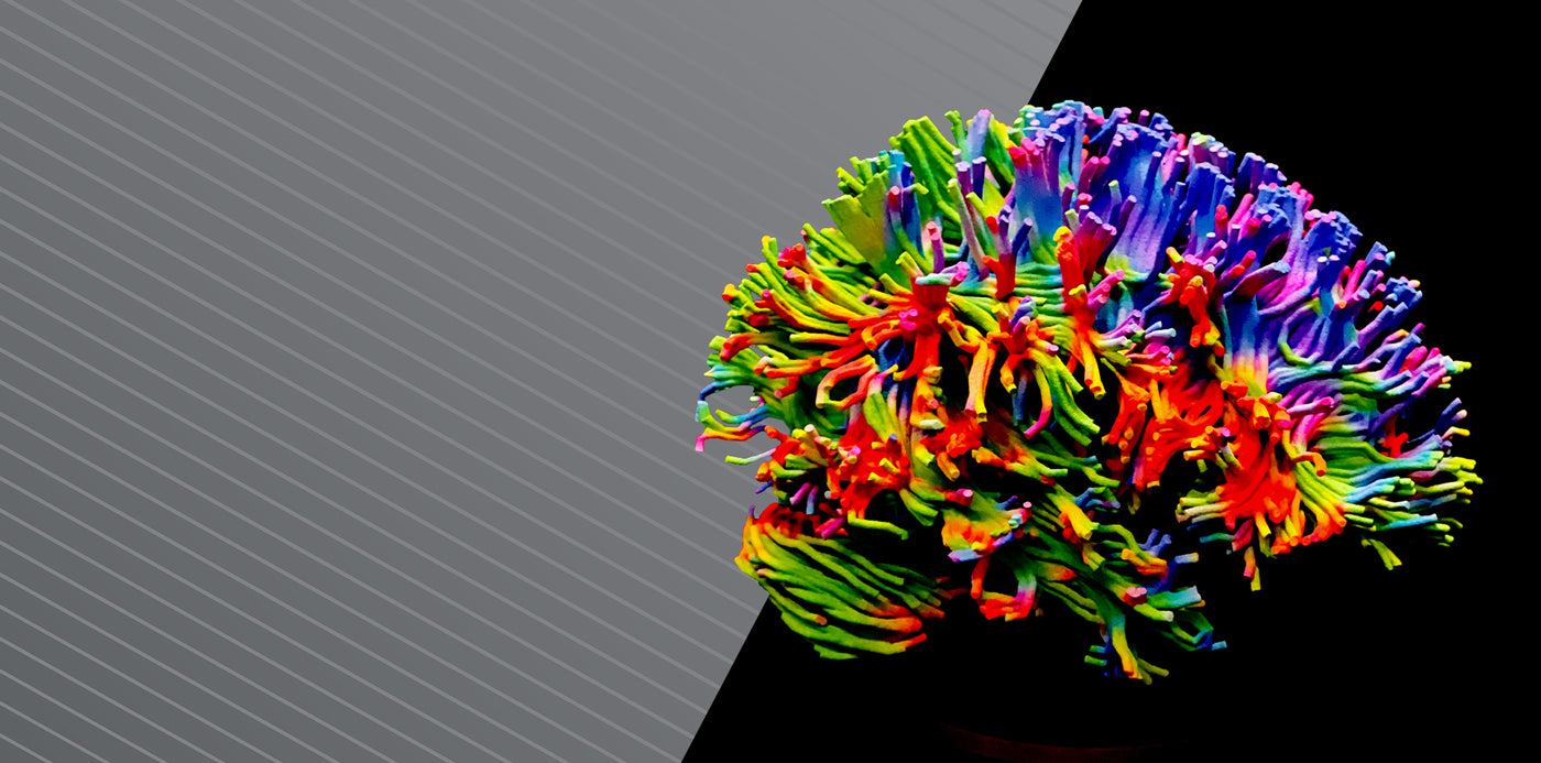 3D Printing Anatomical Models GPI 3D Anatomy