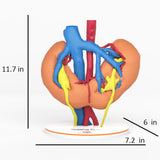 Horseshoe Kidney With Renal Cell Carcinoma (RCC) – Male, 41 Years