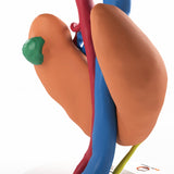 Horseshoe Kidney With Renal Cell Carcinoma (RCC) – Male, 41 Years