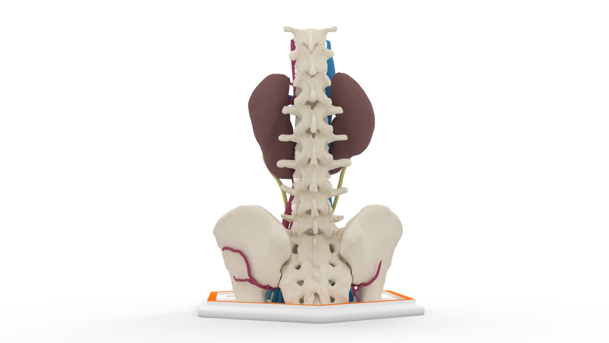 Horseshoe Kidney 19M