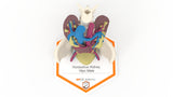 Horseshoe Kidney 19M