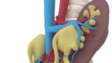 Horseshoe Kidney 7M