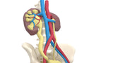 Mega Ureter 10 M