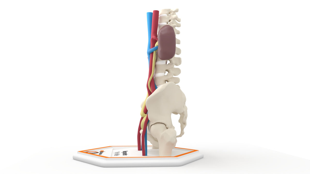 Mega Ureter 10 M