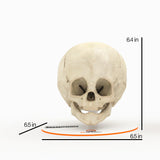 Infant Skull With Craniosynostosis of the Metopic Suture - Male, 8 Months