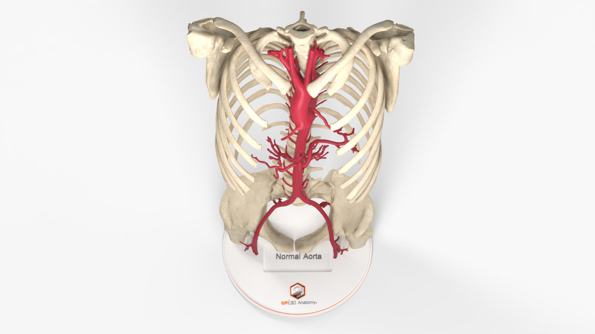 Custom 3D Anatomy Models | Aorta | Aortic Valve | Aortic Arch | 3D ...