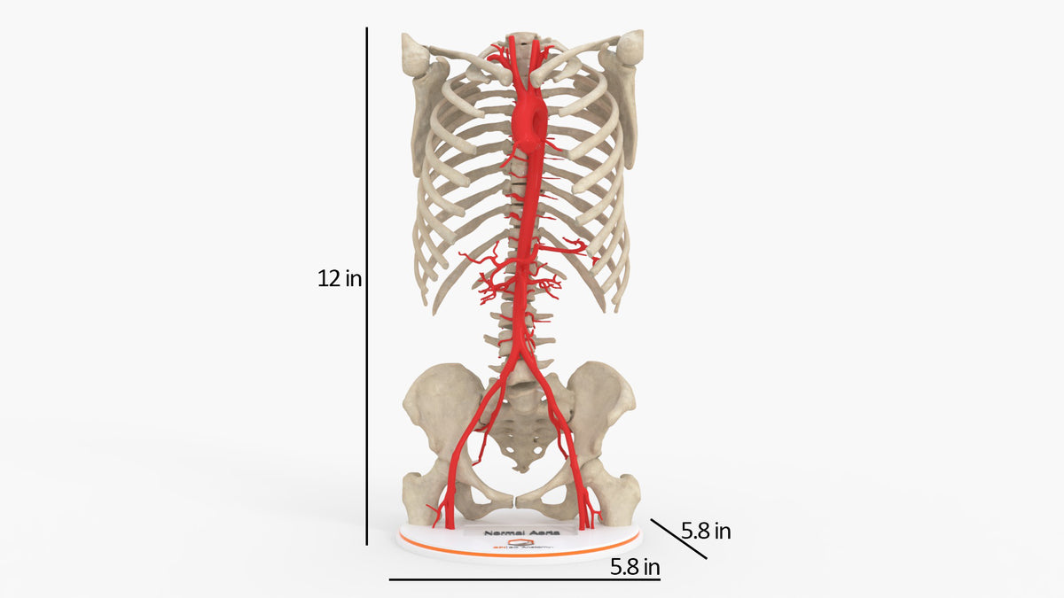 Custom 3D Anatomy Models | Aorta | Aortic Valve | Aortic Arch ...