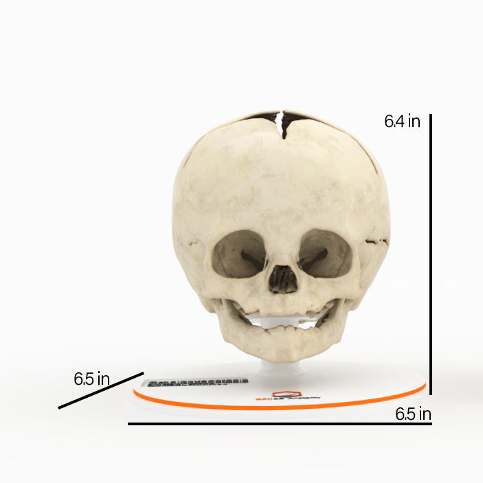 Infant Skull, Normal - Male, 8 Months