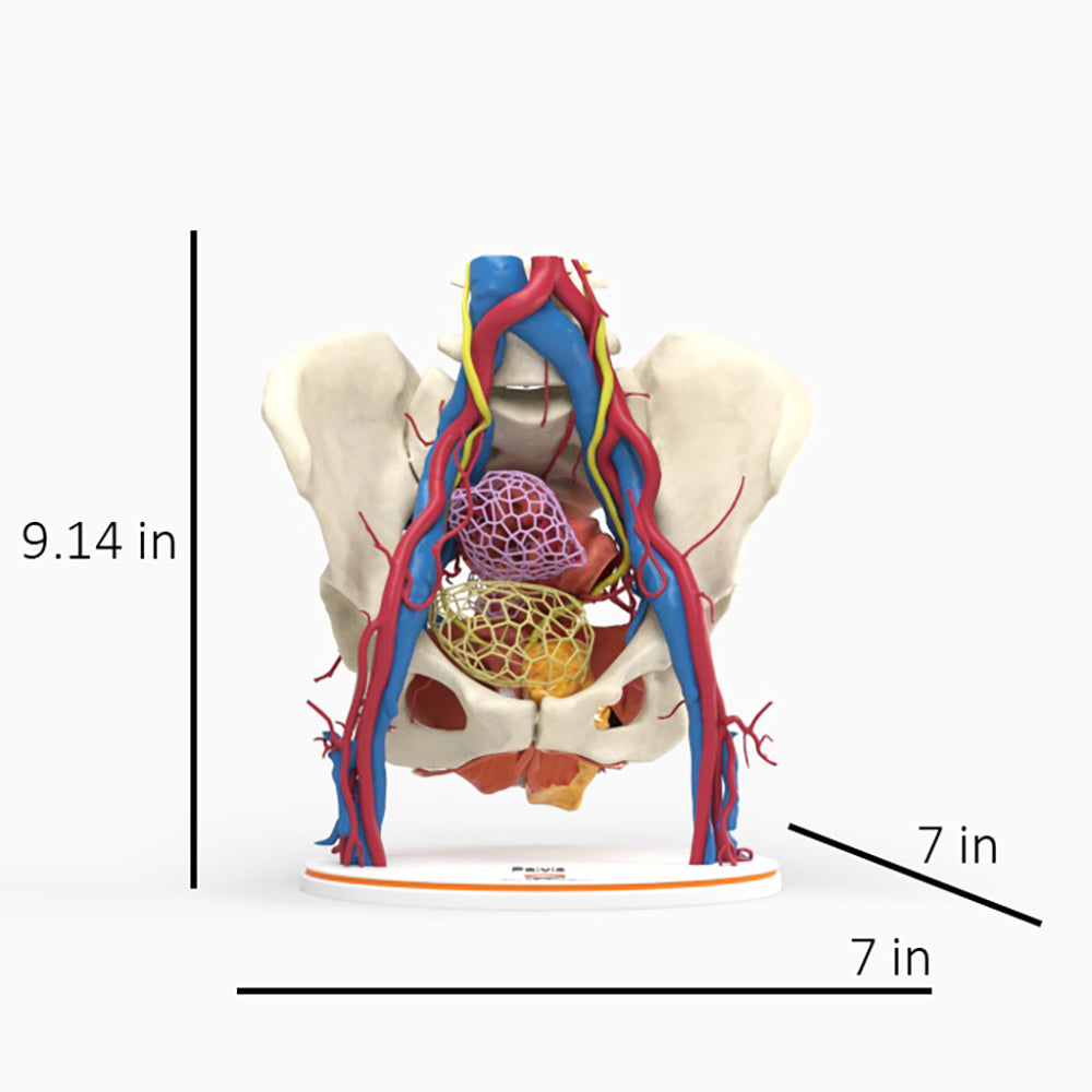 Pelvic Hernia – Female, 48 Years