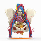 Pelvic Hernia – Female, 48 Years