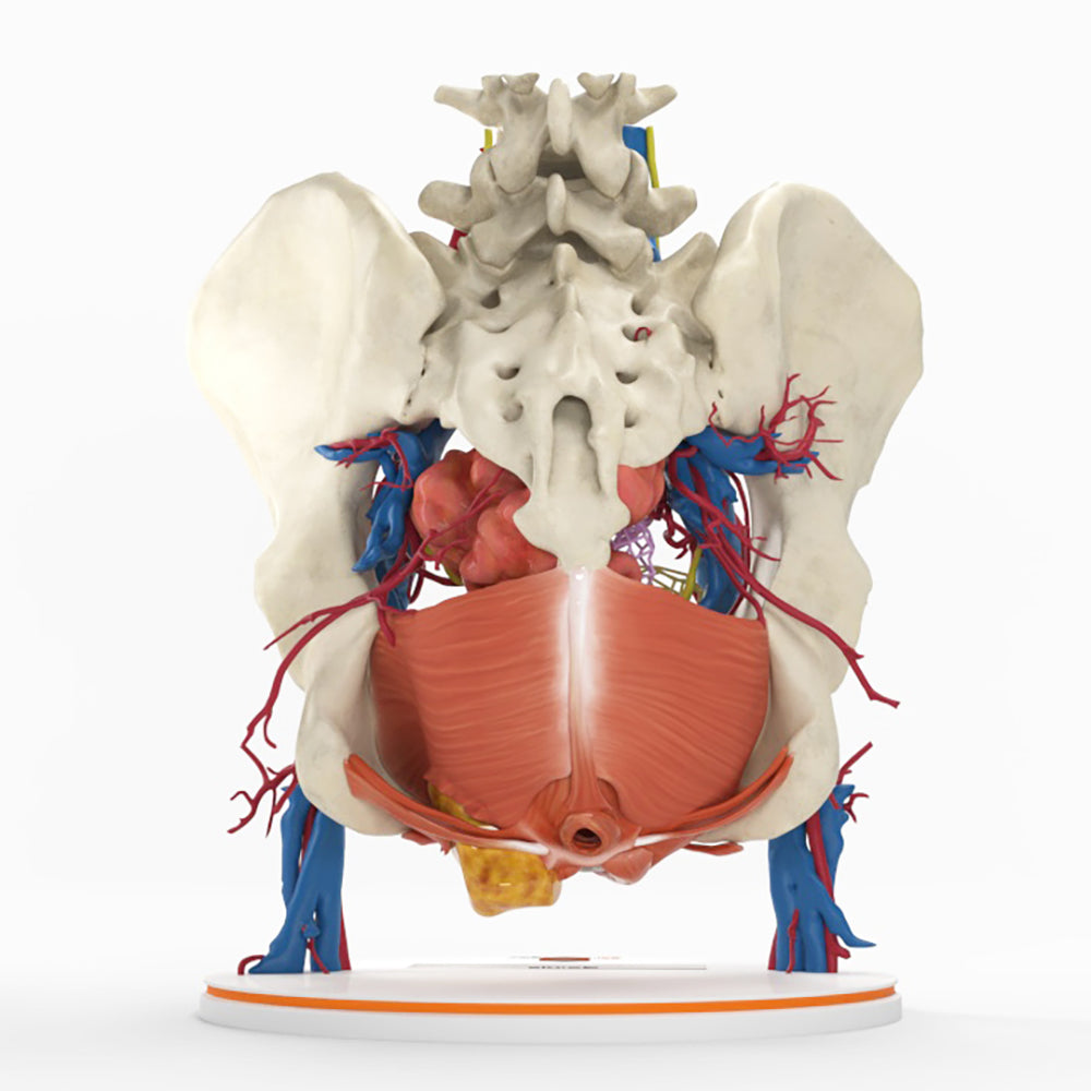 Pelvic Hernia – Female, 48 Years