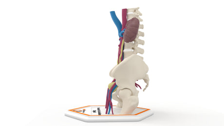 Persistent Fetal Lobulation