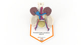 Persistent Fetal Lobulation