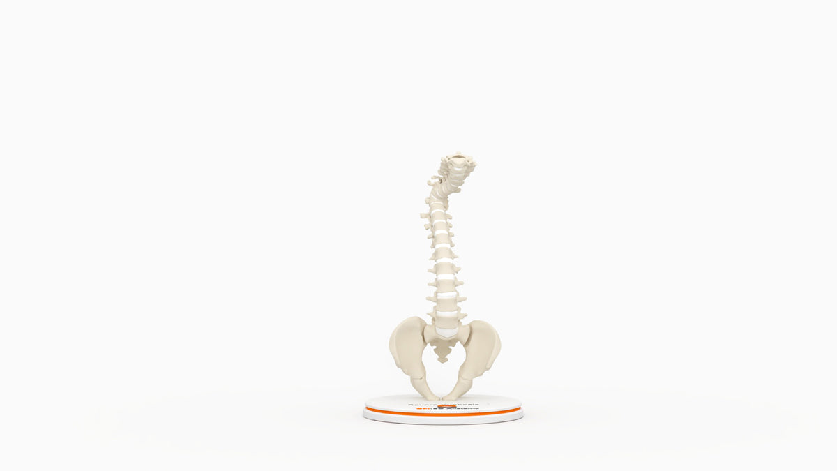Severe Kyphosis