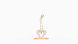 Severe Kyphosis