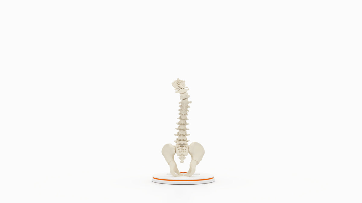 Severe Kyphosis