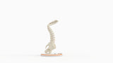 Severe Kyphosis