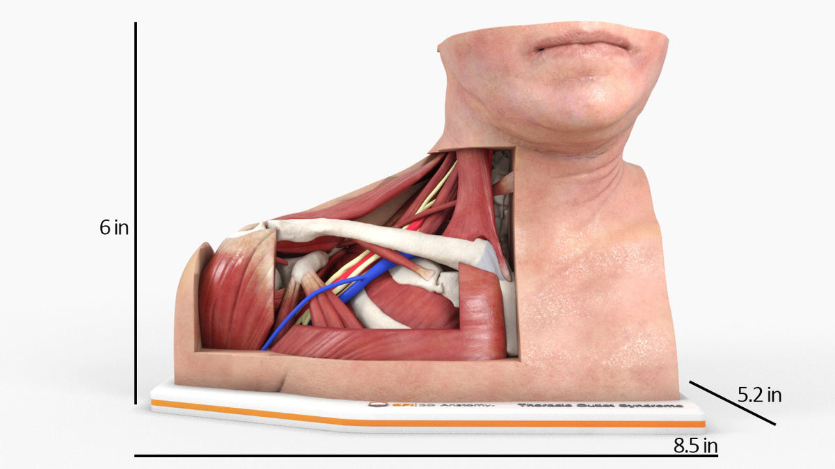 Custom 3D Anatomy Models | Thoracic Outlet Syndrome (TOS) | Thoracic ...