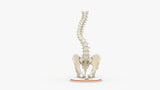 Scoliosis Type-1 Idiopathic 10