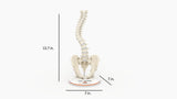 Scoliosis Type-1 Idiopathic 10