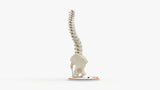 Scoliosis Type-1 Idiopathic 10