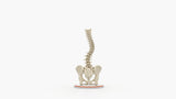 Scoliosis Type-1 Idiopathic 1
