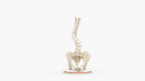 Scoliosis Type-1 Idiopathic 1