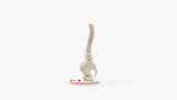 Scoliosis Type-1 Idiopathic 1