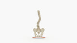 Scoliosis Type-1 Idiopathic 2