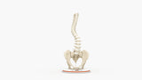 Scoliosis Type-1 Idiopathic 2