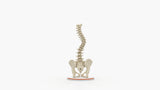 Scoliosis Type-1 Idiopathic 5
