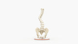 Scoliosis Type-1 Idiopathic 5