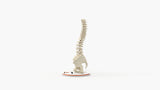 Scoliosis Type-1 Idiopathic 5
