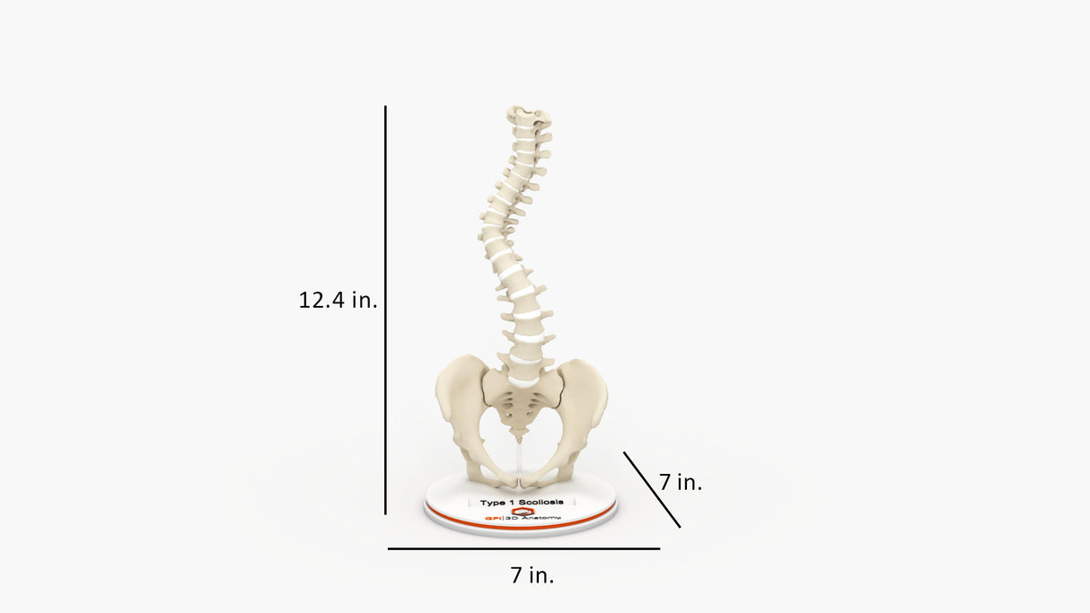 Scoliosis Type-1 Idiopathic 5