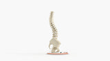 Scoliosis Type-1 Idiopathic 5