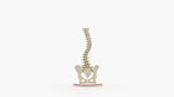 Scoliosis Type-1 Idiopathic 6
