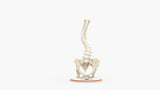 Scoliosis Type-1 Idiopathic 6