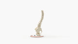 Scoliosis Type-1 Idiopathic 6