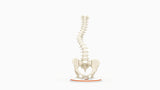 Scoliosis Type-1 Idiopathic 8