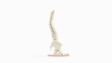 Scoliosis Type-1 Idiopathic 8