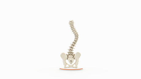 Scoliosis Type-1 Idiopathic 9
