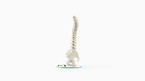 Scoliosis Type-1 Idiopathic 9