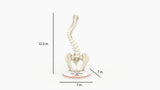 Scoliosis Type-1 Idiopathic 9