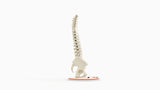 Scoliosis Type-1 Idiopathic 9