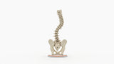 Scoliosis Type-2 Model 2