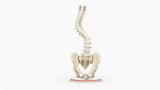 Scoliosis Type-2 Model 2