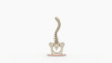 Scoliosis Type-2 Model 4