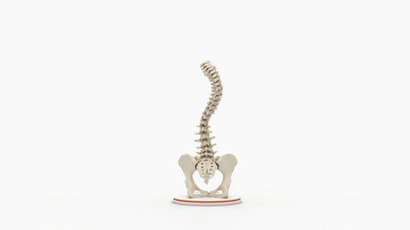 Scoliosis Type-2 Model 4
