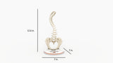 Scoliosis Type-2 Model 4