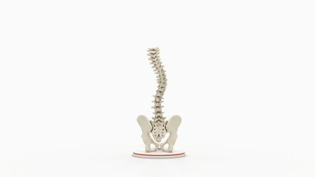 Scoliosis Type-2 Model 5